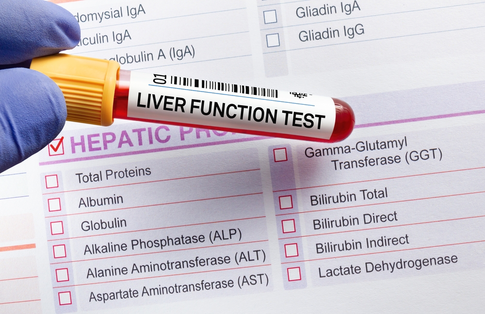 LFT (LIVER FUNCTION TEST)