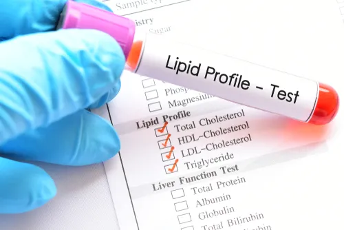 LIPID PROFILE  TEST