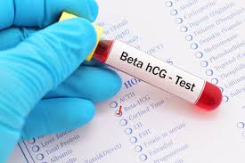 TOTAL BETA-HCG 