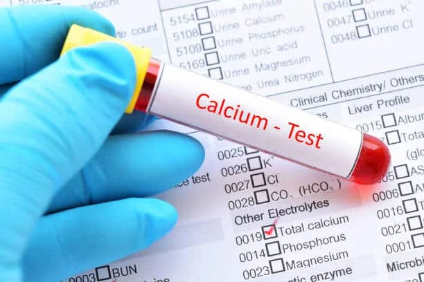 CALCIUM
